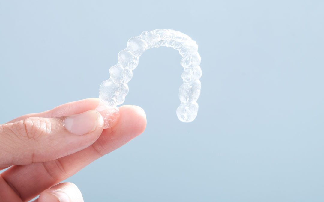 The Invisalign Timeline: How Long Does the Invisalign Process Take?