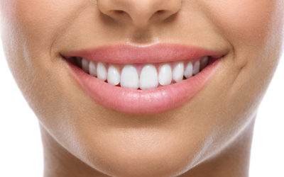 Your Guide to Smile Makeovers: Options, Planning and Costs