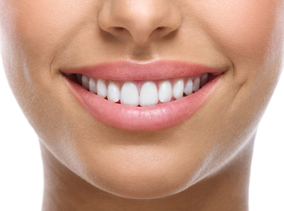 Your Guide to Smile Makeovers Options, Planning and Costs