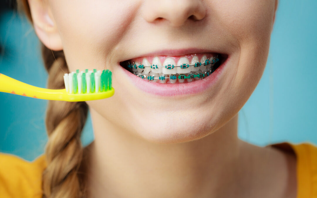 How to Brush Teeth with Braces: Tips and Tricks
