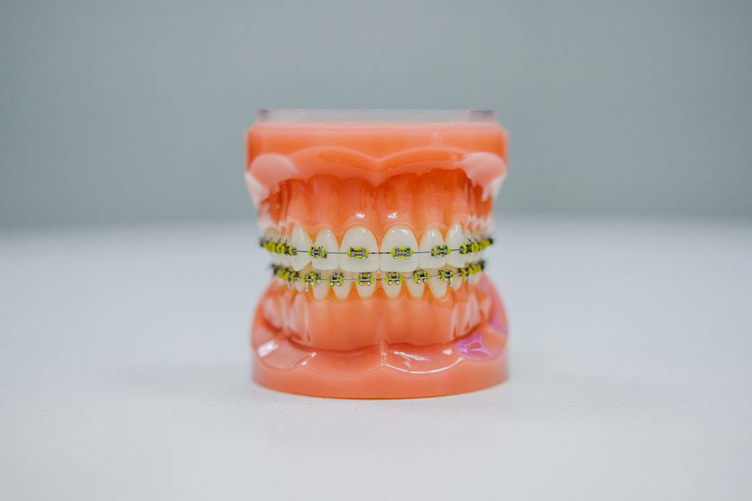 open bite
