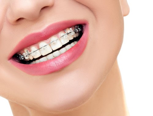 orthodontics