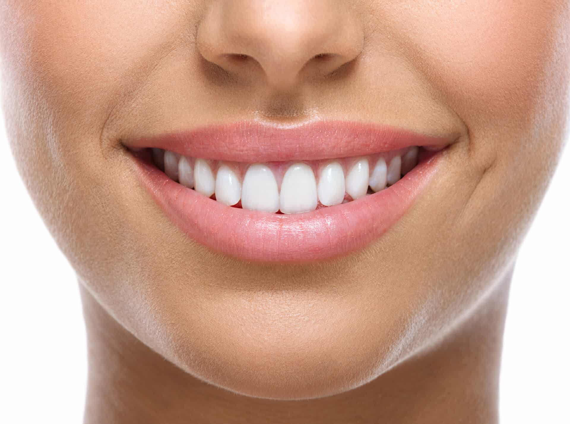 smile makeovers